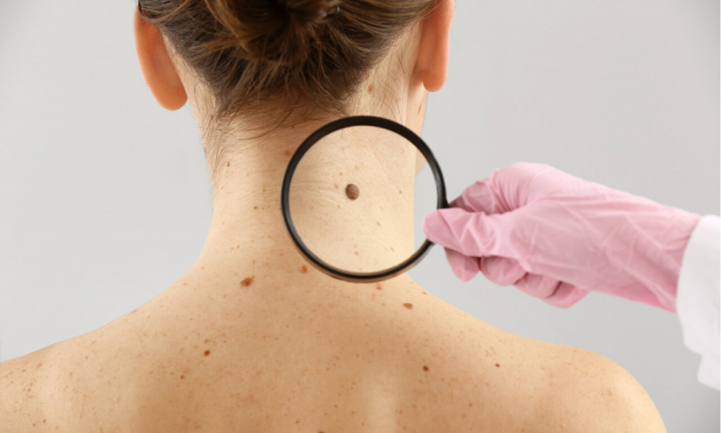 TUNA AND OUR SKIN HEALTH