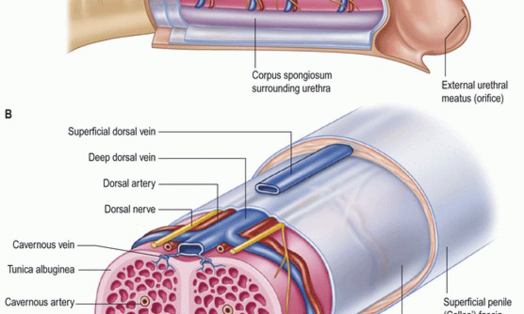 Penile Cancer