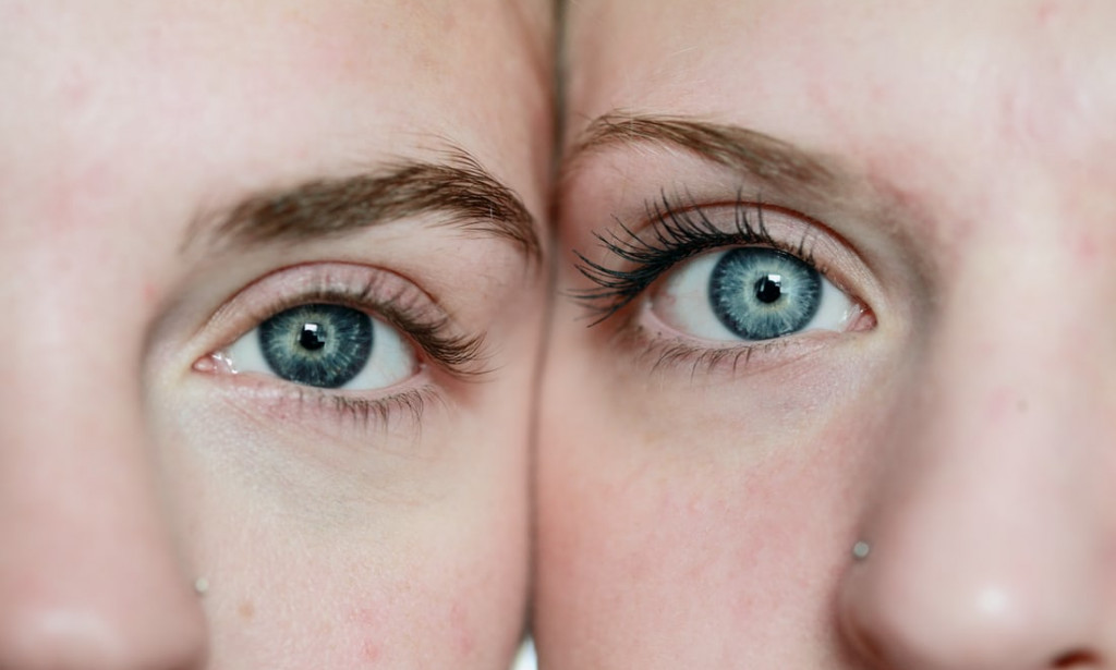 HOW TO TREAT YOUR EYE PROBLEM WITHIN SEVEN DAYS