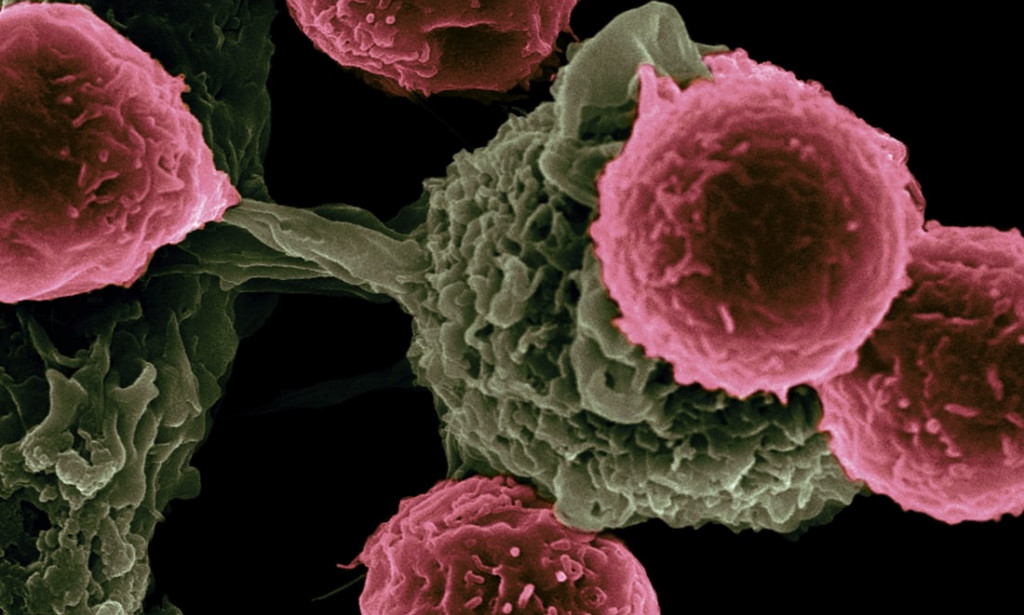 5 best cancer-fighting foods