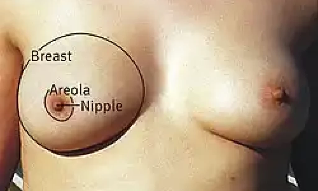 Breast Cancer