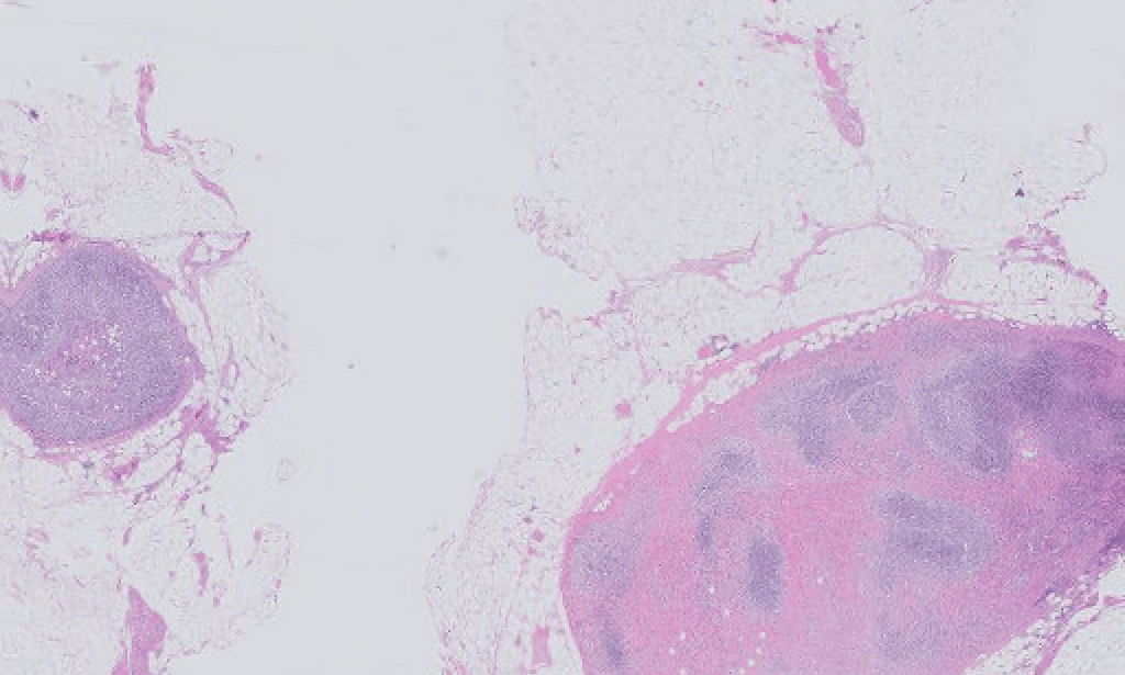 How can freelancers boost their earnings during inflationary times