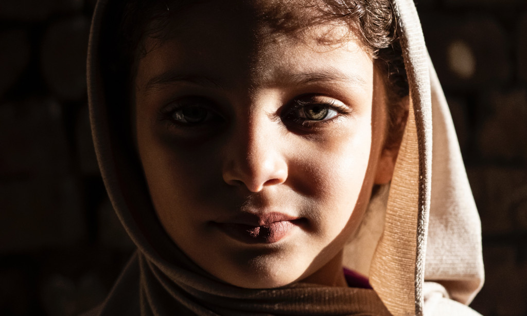 Signs and Symptoms of Stress In Children.