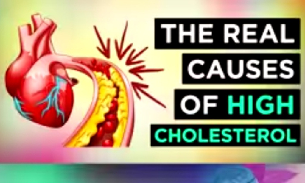 The Real Causes of High Cholesterol
