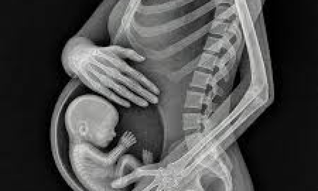 When the Pregnancy Journey Ends Before It Begins