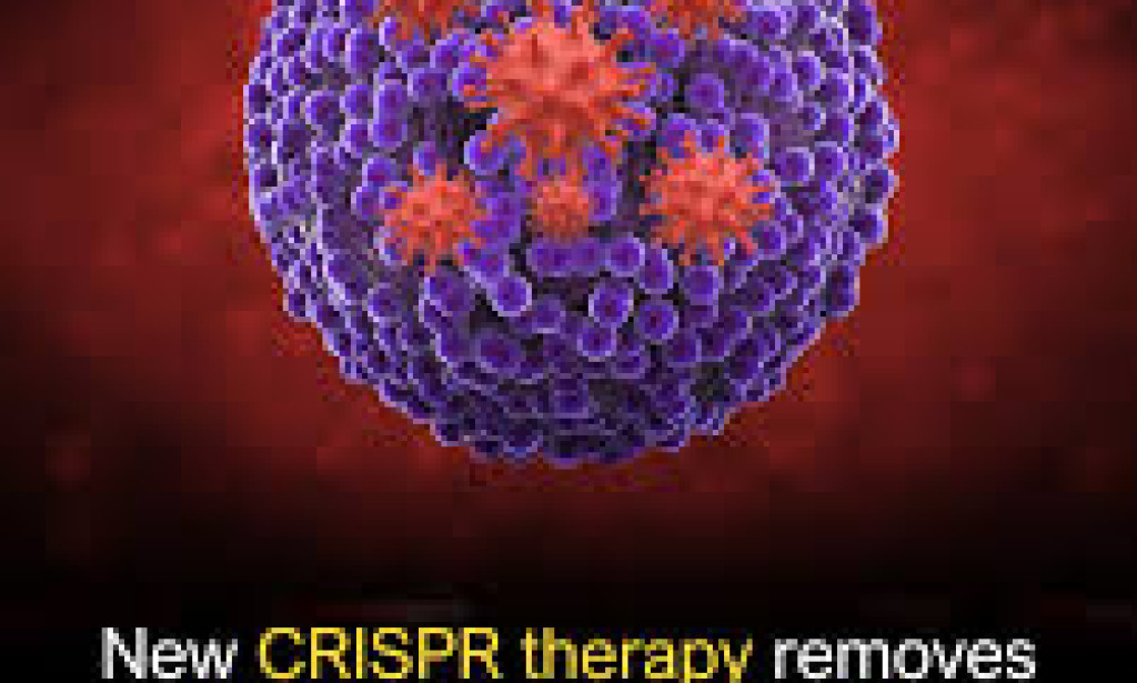 New CRISPR Therapy Completely Removes HIV DNA From Infected Human Cells and Prevents Virus From Returning.