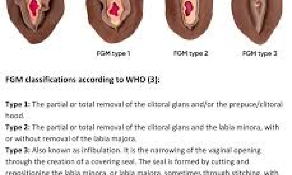 Can FGM be a personal choice?