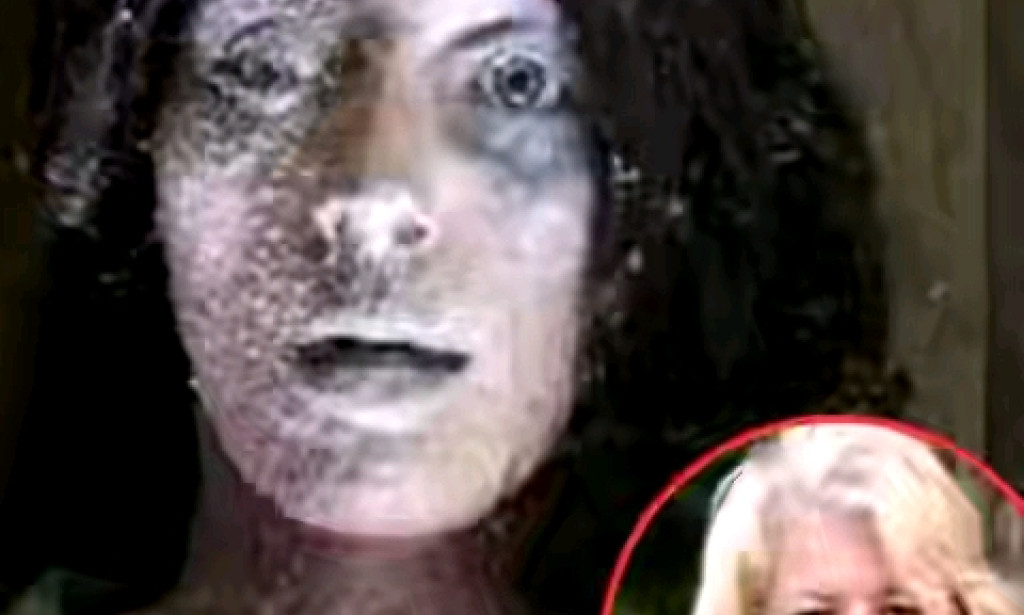 SHE COLLAPSED, UNCONSCIOUS AND REMAINED IN COLD ICE FOR SIX HOURS,HER BODY COMPLETELY FROZEN.